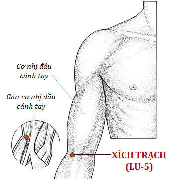 Cứu ngải huyệt xích trạch chữa ho